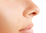 Rhinoplasty