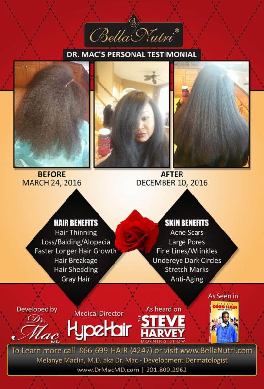 Announcing Bellanutri 90 Day Hair Growth Challenge Join Dr Melanye Maclin In The 90 Day Hair Growth Challenge With Bellanutri As Seen Above Reveals Her Own Personal Challenges And Shares