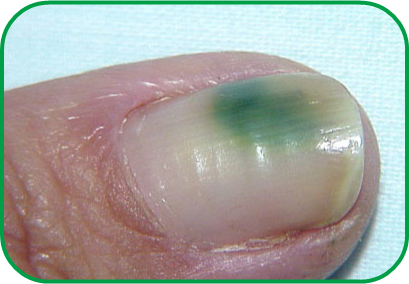 The Nail Studio Newsletter New Pampering Foot Spa Understanding Perhaps Not So Lovely To Look At And A Bit Concerning If You Are Unfamiliar With What Is Also Known As The Greenies It Nothing Be Alarmed About