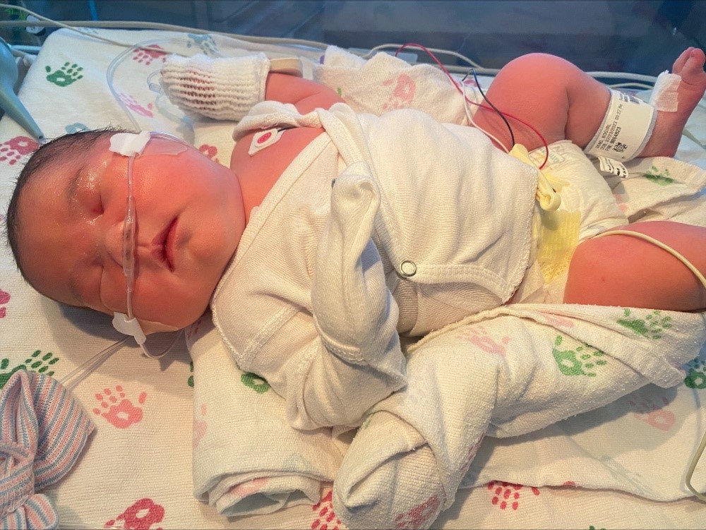 Picture of baby summer