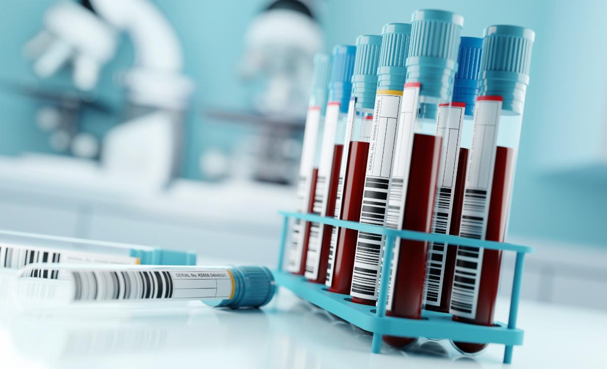 blood test tubes in a test tube rack in a laboratory