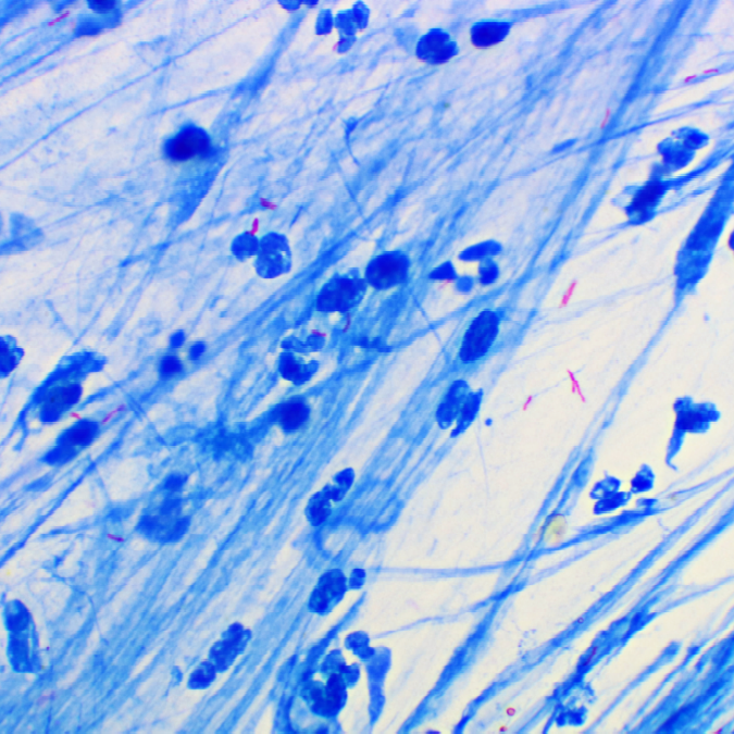 A color photo of Mycobacterium tuberculosis Credit: Shutterstock contributor Jarun Ontakrai