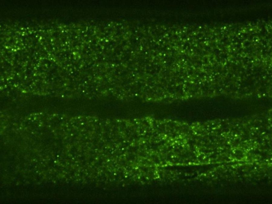 Microscope image shows fluorescent green GEM particles scattered across worm tissue