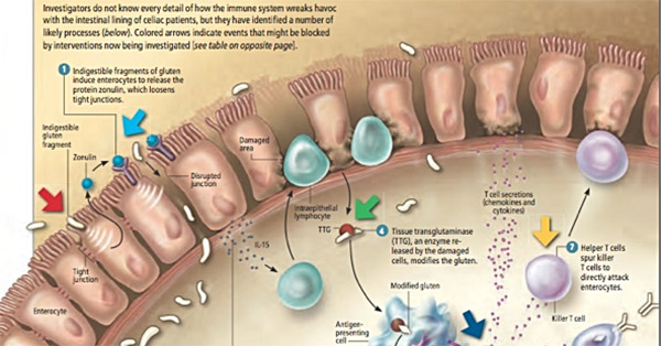 Leaky Gut