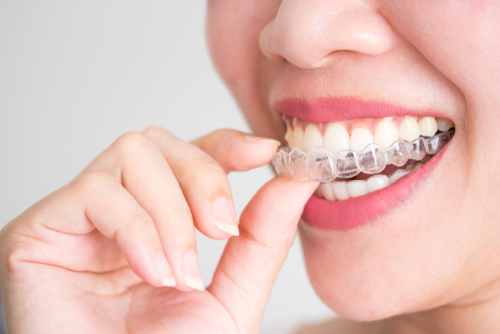 A smiling woman holding invisalign or invisible braces_ orthodontic equipment