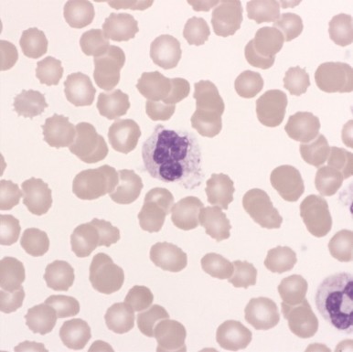 HORIBA's HaemInsights newsletter - blood smear