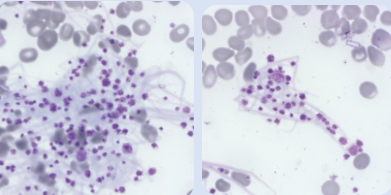 HORIBA's HaemInsights newsletter - numerous features in the tail of a blood smear