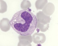 HORIBA's HaemInsights newsletter - Band Cell of Stab Cell