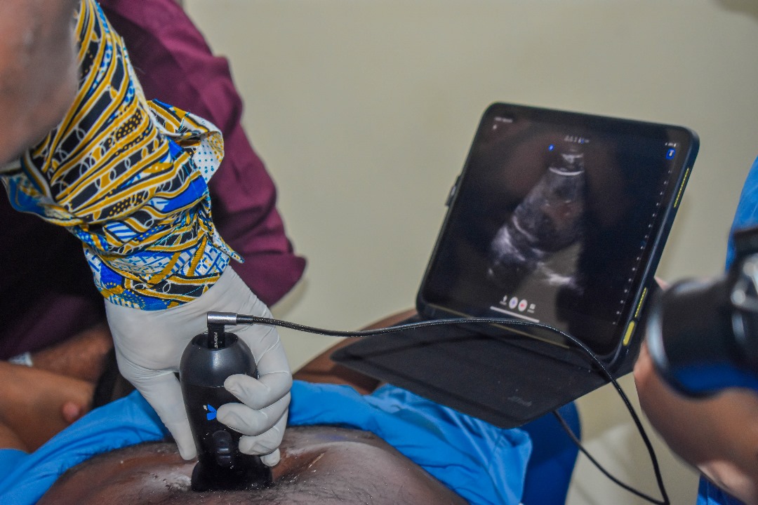 A gloved hand uses a wand on a persons abdomen to see an image on the small screen of a portable ultrasound machine.