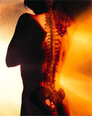 back pain