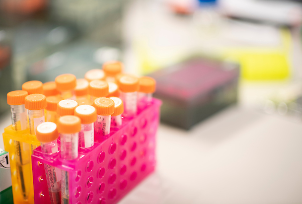 Test tubes in a UNT lab