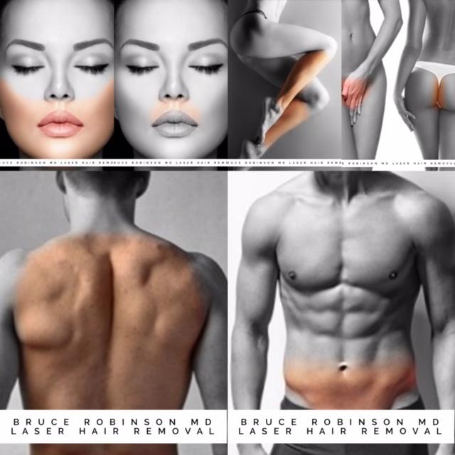 Save On Laser Hair Removal November Promo Tired Of Razor Bumps