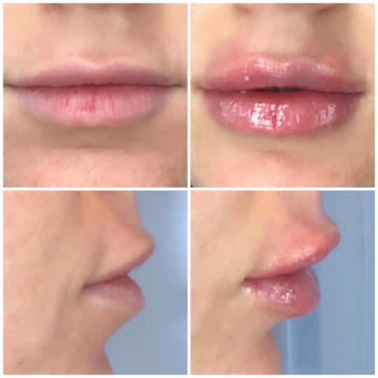 Get ready to be transformed