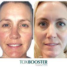 Toxbooster photo.jpg