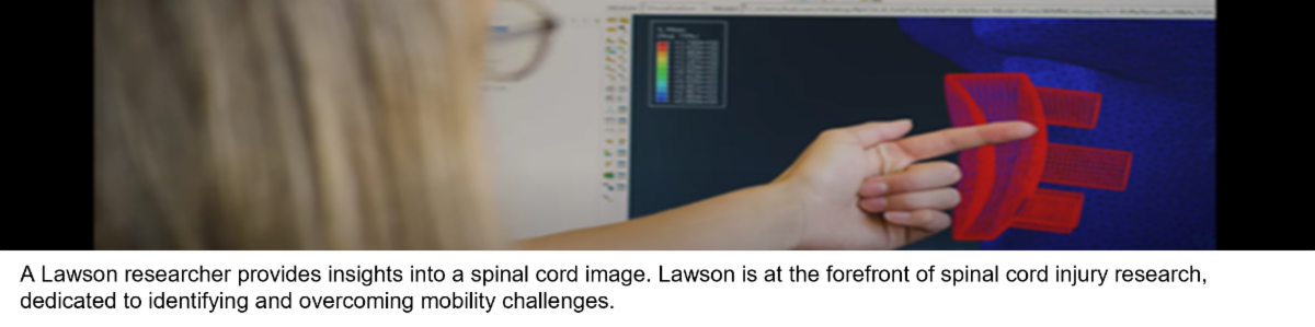 A Lawson researcher provides insights into a spinal cord image