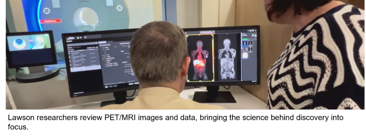 Lawson researchers review PET/MRI images and data, bringing the science behind discovery into focus.