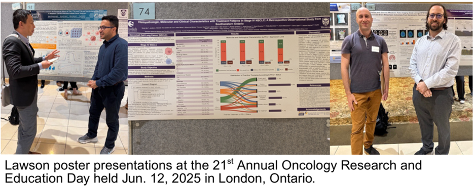 Lawson poster presentations at the 21st Annual Oncology Research and Education Day held Jun. 12 2025 in London Ontario.