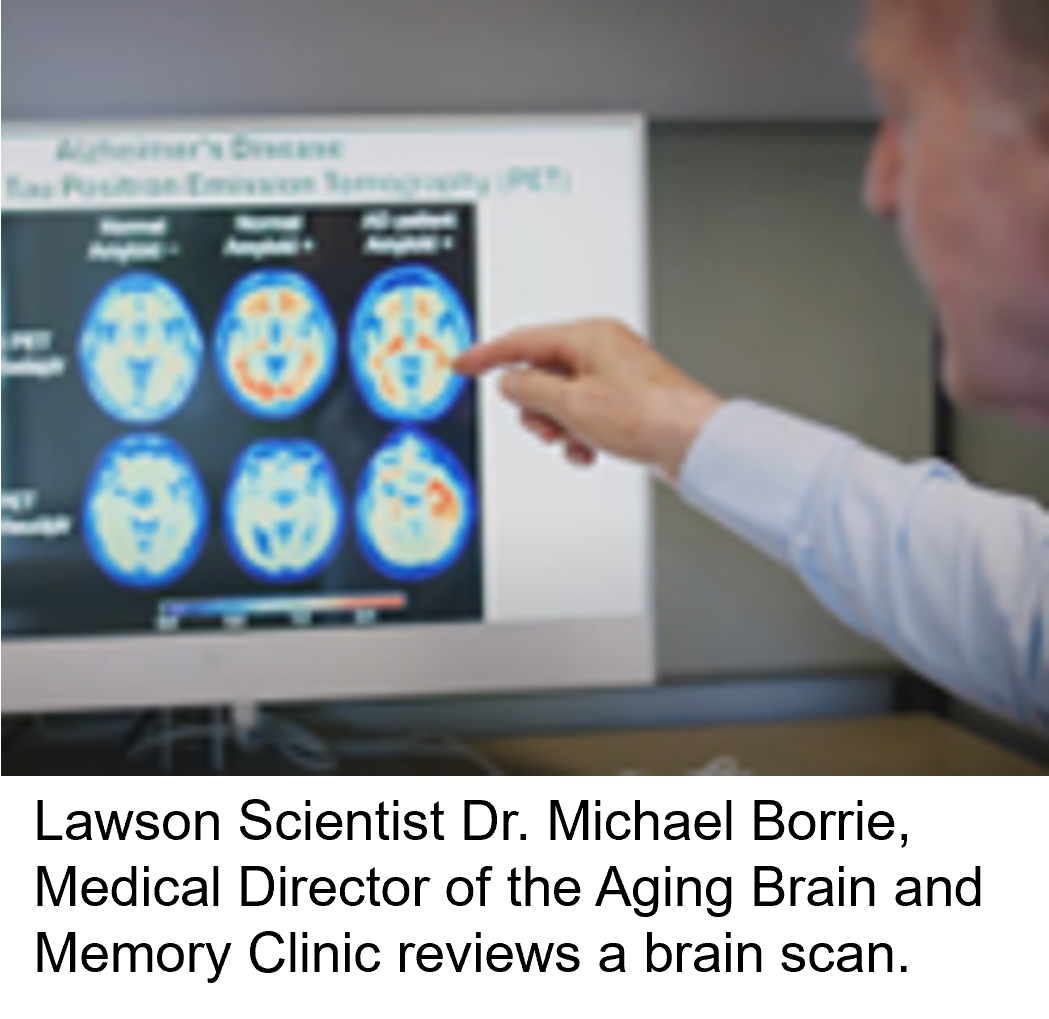 Lawson Scientist Dr Michael Borrie Medical Director of the Aging Brain and Memory Clinic reviews a brain scan