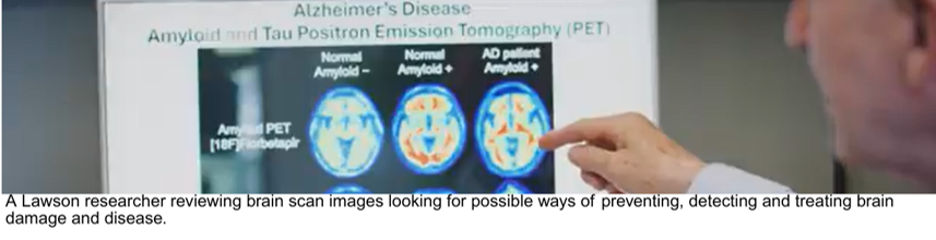 A Lawson researcher reviewing bran scan images looking for possible ways of preventing, detecting and treating brain damage and disease.