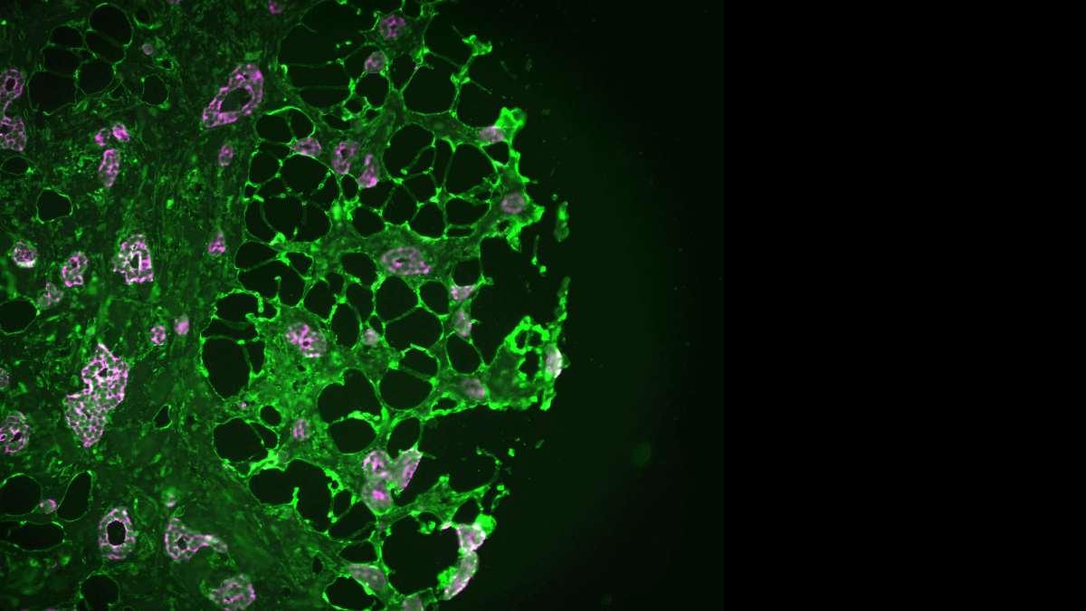 Green microscopic circular particles against black.