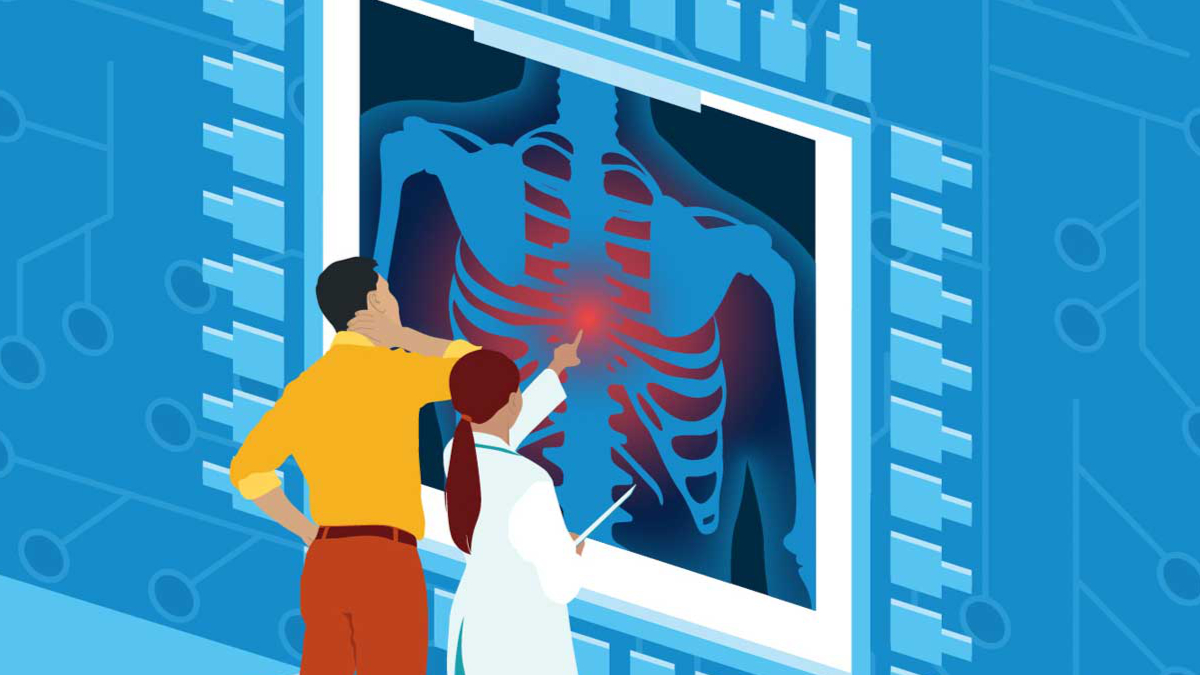 Illustration of a clinician and another person looking at a large diagram of the human ribcage