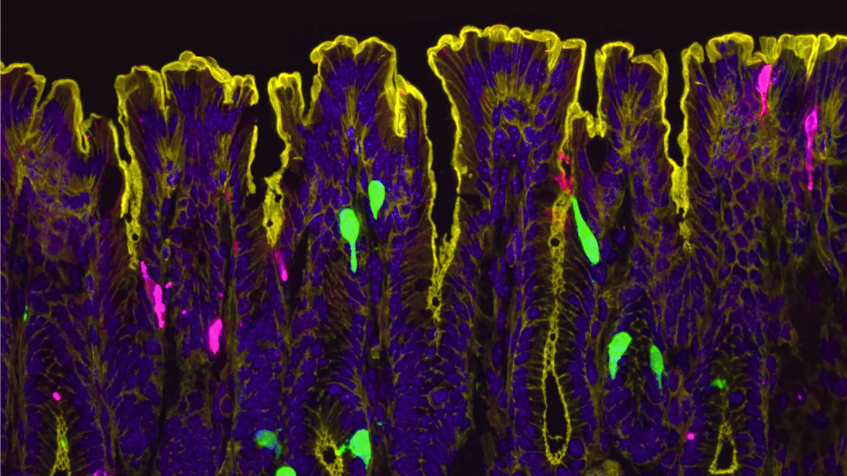 Microscopy image of the gut lining