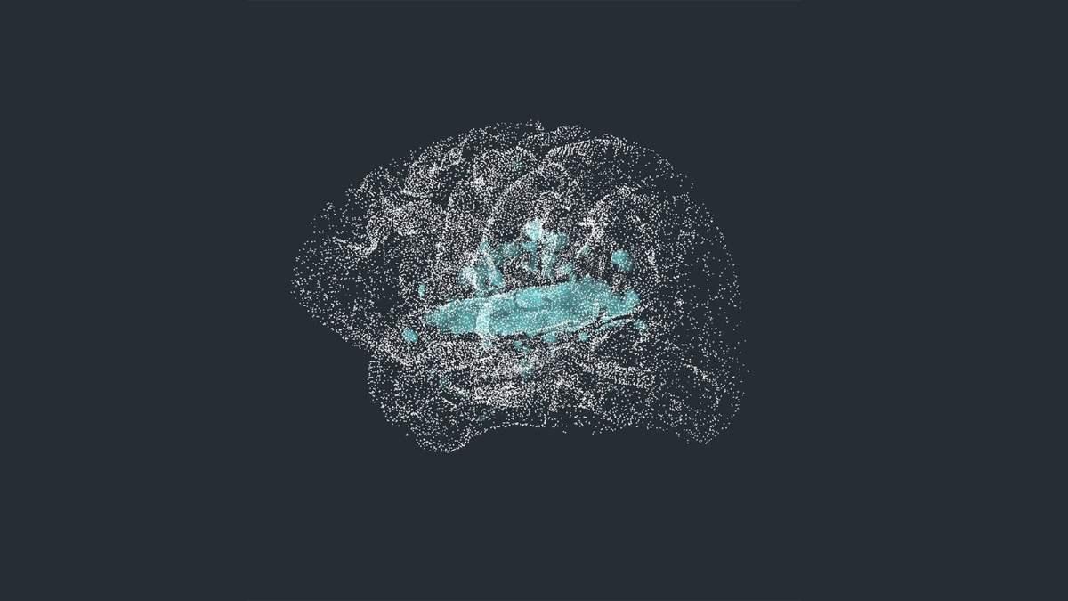 Digital point-cloud illustration of a human brain