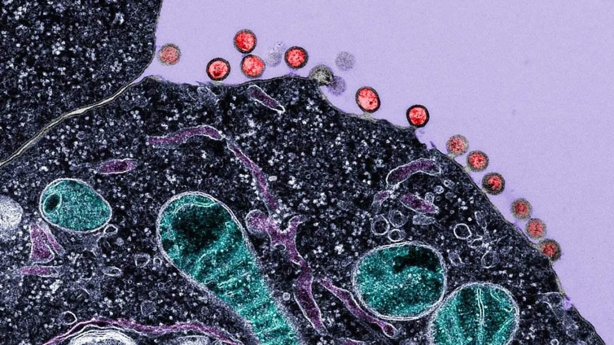 Microscopic image showing cell structures with red viral particles along the edge