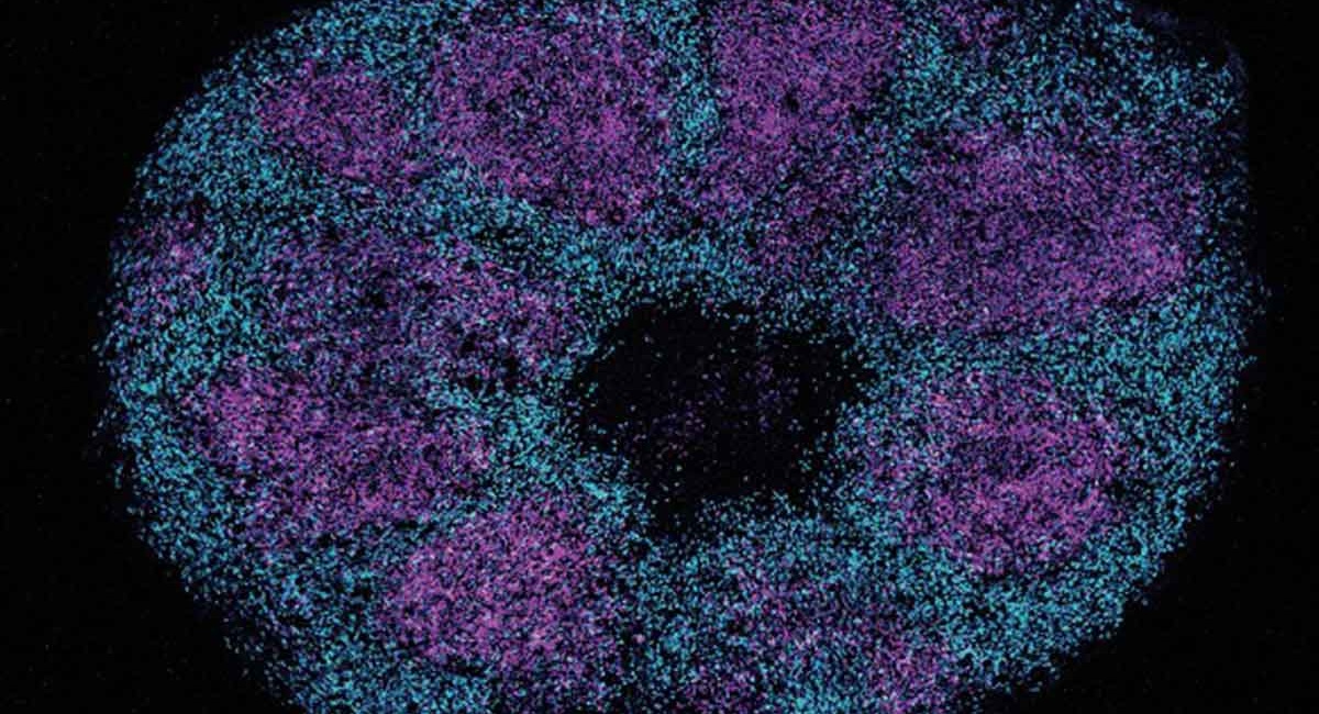 Microscopic image of a brain organoid showing magenta rings of progenitor cells surrounded by dense networks of cyan cortical neurons.