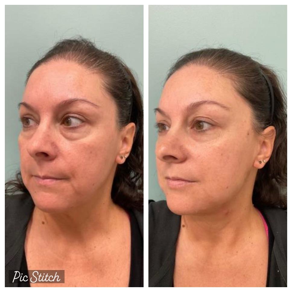 Lunchtime lifts check out these results👀