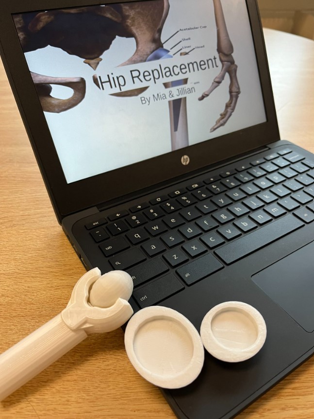 3D Printed Prosthetics at Caradoc Public School  