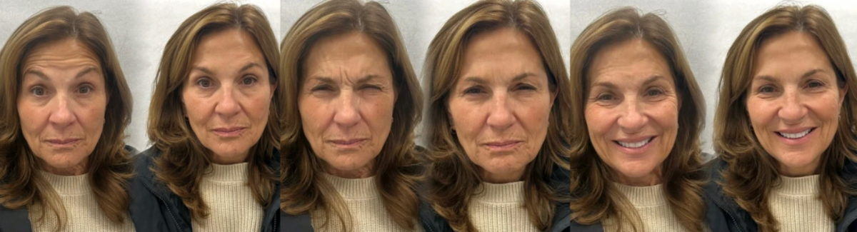 Patient Before and After Results