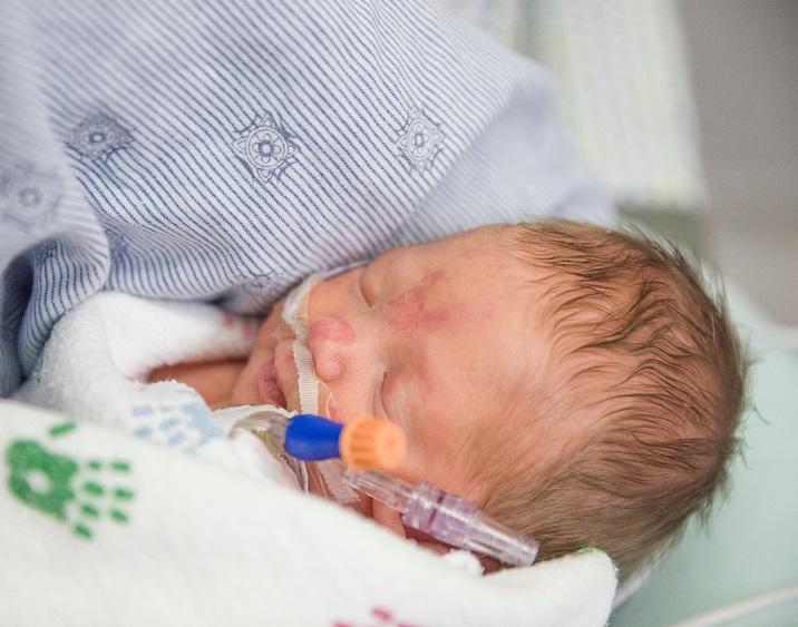 a premature infant in the hospital