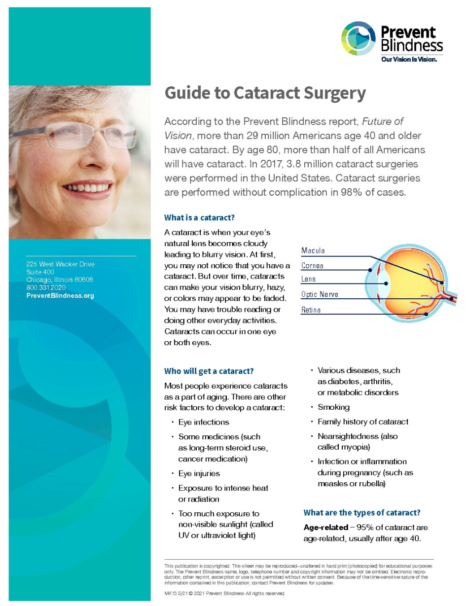 Guide to Cataract Surgery Cover