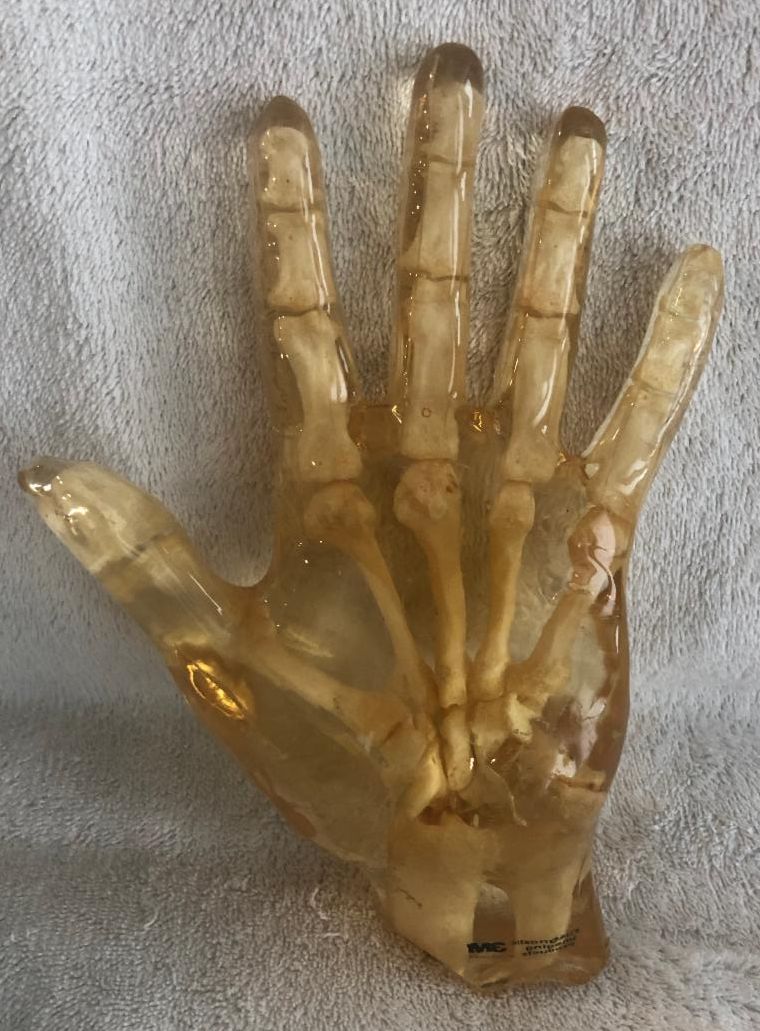 Hand Phantom