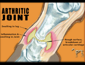 Journey Joints Arthritic