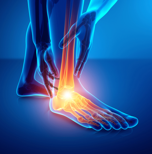 3d Illustration of Male foot with ankle pain