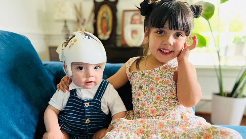 Parents’ instincts and early action lead to positive outcome for Houston infant with sagittal craniosynostosis treated by UTHealth Houston