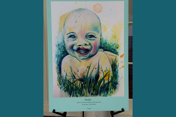 100 Cleft Portraits Tour 