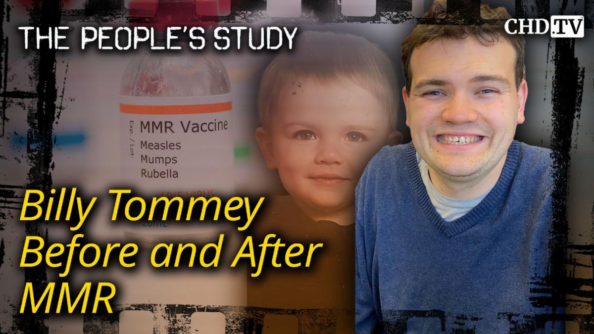 Billy Tommey before and after MMR