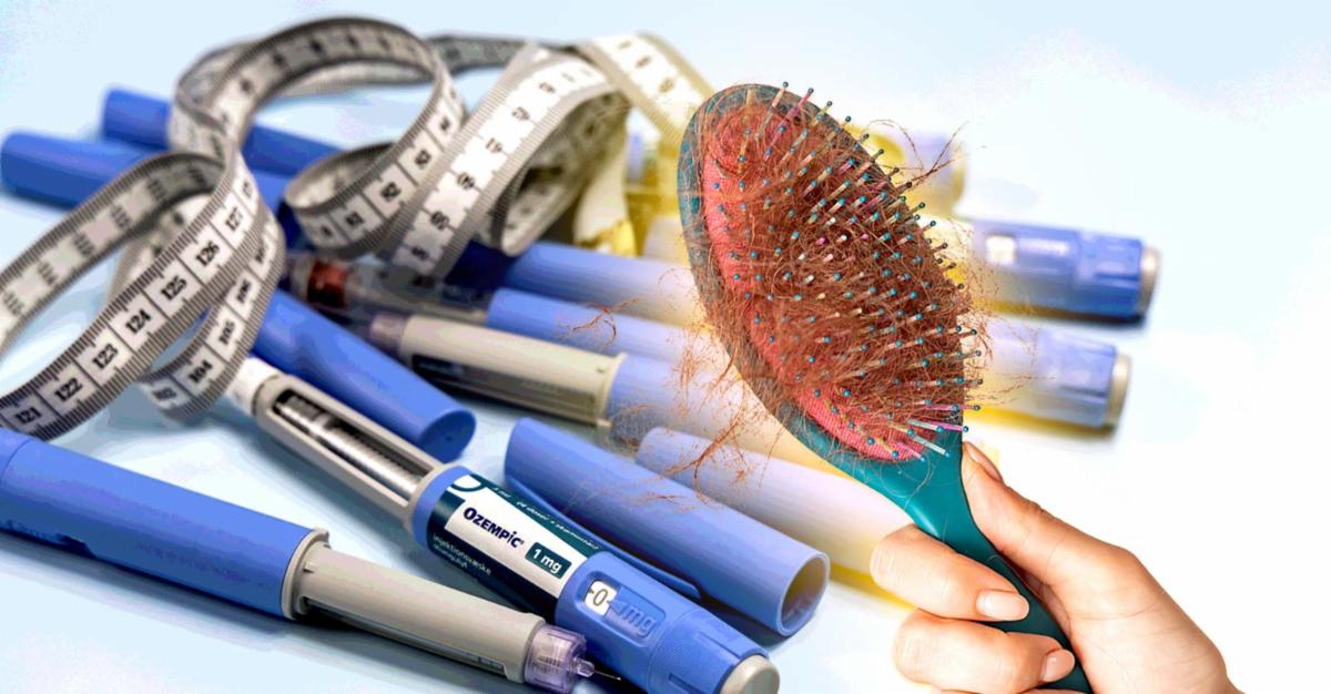 ozempic and hair brush with a lot of hair on it