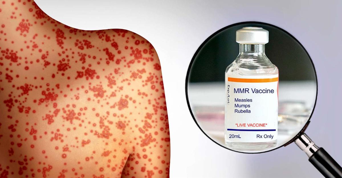 mmr vaccine
