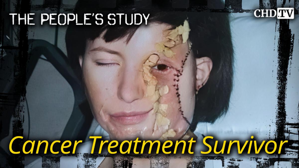 Cancer Treatment Survivor