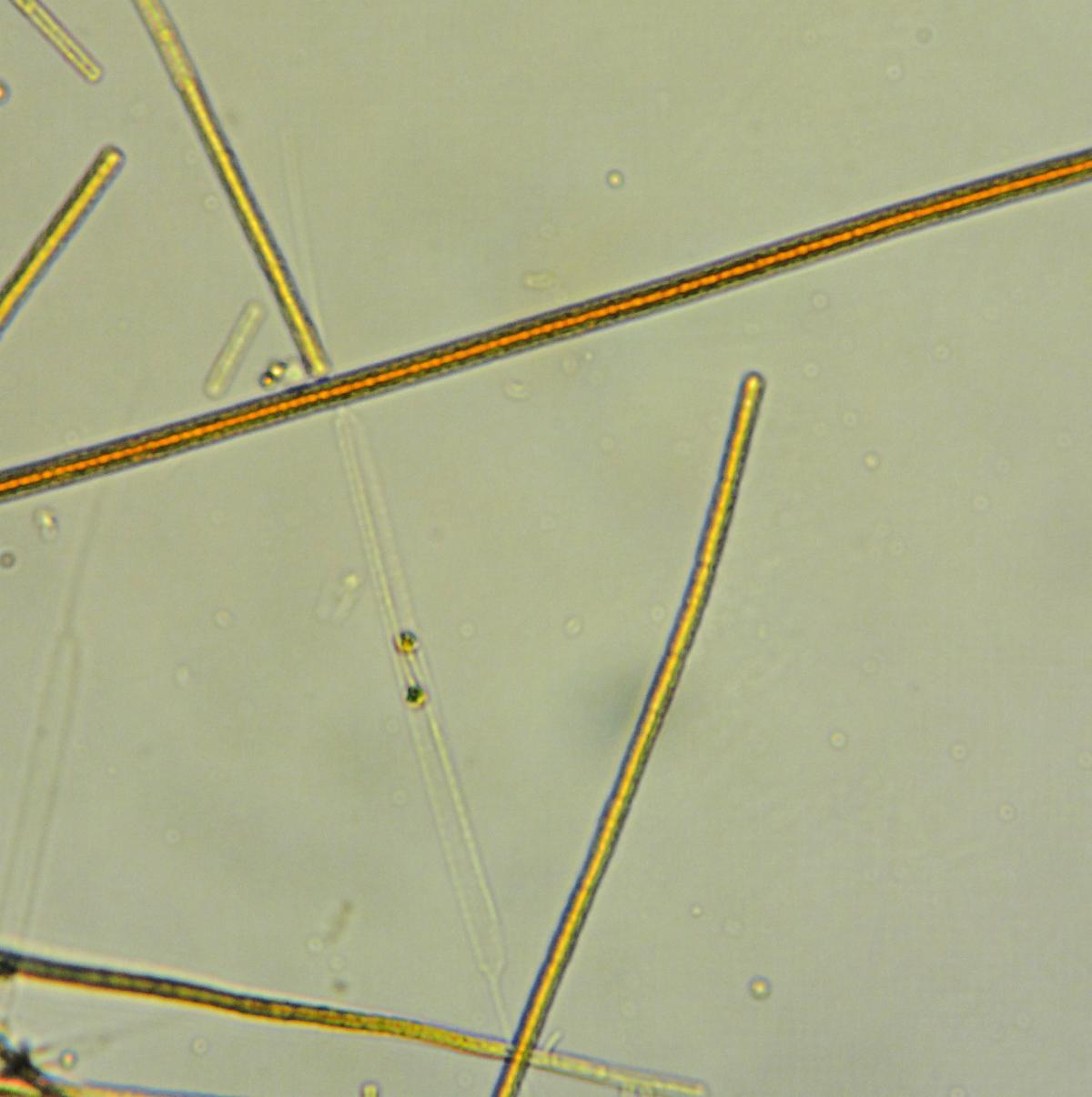 pseudanabaena algae as seen under a microscope