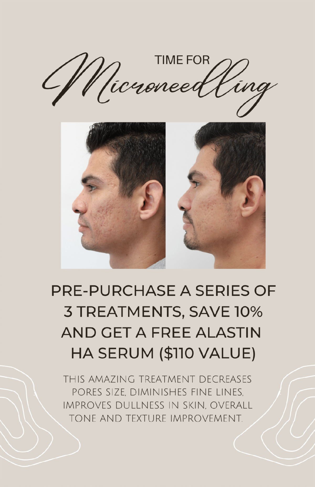 Get lucky in Santa Monica with these special offers.png