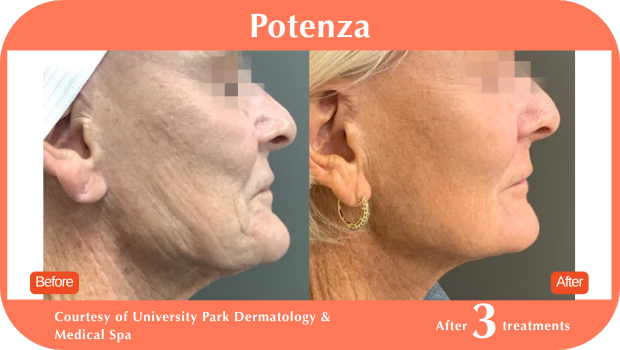 Potenza BA