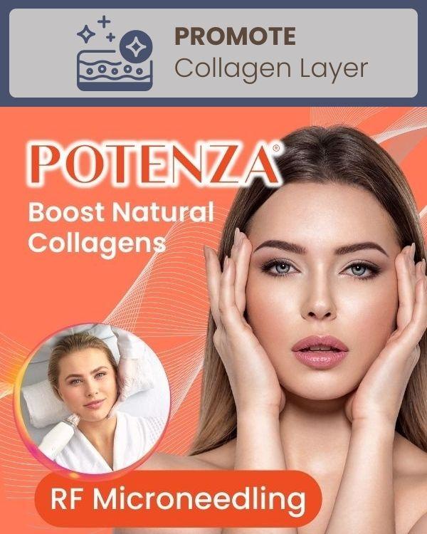 Promote Collagen Potenza