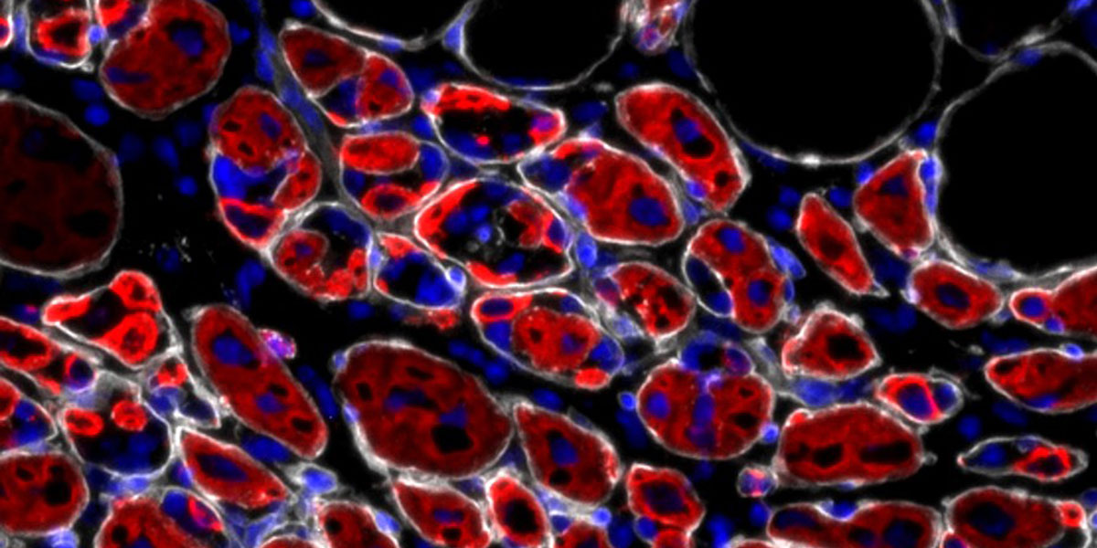 Regenerating muscle. Image credit: Alessandra Sacco, Lale Cecchini, Sanford Burnham Prebys.