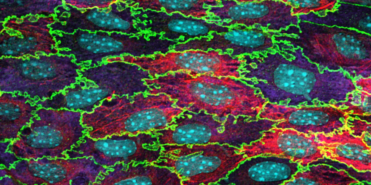 Confocal micrograph of mouse aortic endothelium