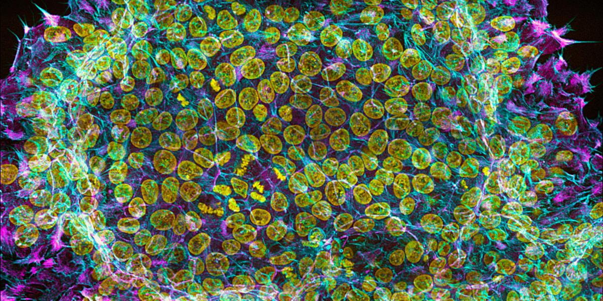 human embryonic stem cell colony